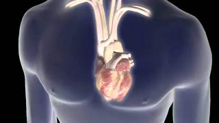 Atrial Fibrillation AFib Animation [upl. by Janetta]