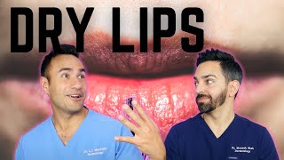 DRY CHAPPED LIPS DERMATOLOGY TIPS [upl. by Atiuqehc]