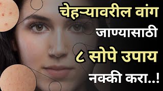 चेहऱ्यावरील वांग जाण्यासाठी ८ सोपे उपाय नक्की करा  Pigmentation Treatment On Face In Marathi [upl. by Ardnoed]