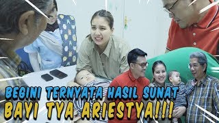 Kontrol sunat Bayi TYA ARIESTYA begini toh bentuknya [upl. by Annua]