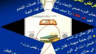 oxyuris طفيليات ديدان الحرقص  الأقصورة [upl. by Ahsila]