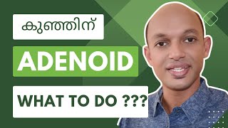 Adenoid problems in children  Symptoms  Treatment DrSandeepKRaj Malayalam [upl. by Kinimod]