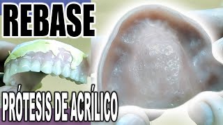 CÓMO HACER UN REBASE A UNA PRÓTESIS DENTAL DE ACRÍLICO PASO A PASO [upl. by Gifferd]