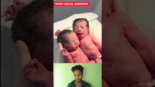 TWINS MIRACLE BABY 😘birth junior newbornbaby twinsbaby viralshorts shortsfeed viral [upl. by Sukhum]