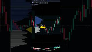 Important Volume Profile Levels [upl. by Anauqes]