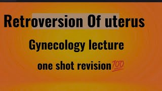 RETROVERSION OF UTERUS  Gynecology lecture [upl. by Reham]