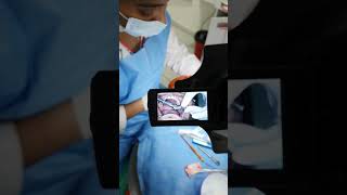 Pterygoid implant placement TTPHIL Tubero pterygoid Pterygomaxillary implants  IDI Live Handson [upl. by Fairleigh]