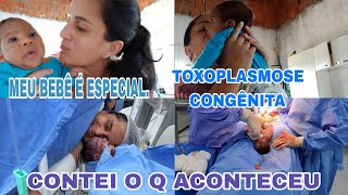 MEU BEBÊ É ESPECIALTOXOPLASMOSE CONGÊNITA CONTEI O QUE ACONTECEU BEBÊ PREMATURO [upl. by Asyla]