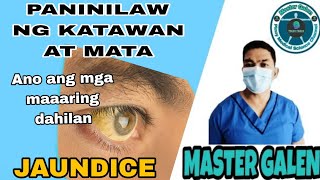 Jaundice paninilaw ng katawan at mata anong dahilan [upl. by Kcor417]