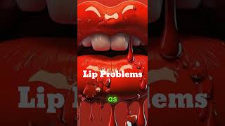 What Are the Most Common Lip Problems and How Can They Be Treated lips shorts fyp foryou [upl. by Narayan]