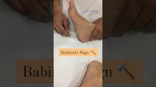 What is babinski reflexsign  neurophysiotherapy reel physiotheraphy [upl. by Wyndham]