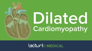 Dilated Cardiomyopathy  Cardiology [upl. by Unders]