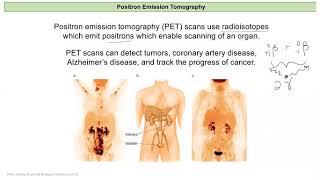 Chem 121 Lecture 10 D Radioisotopes in Medicine [upl. by Bianca]