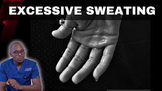 How to Control Excessive Sweating Effective Hyperhidrosis Treatment [upl. by Mazur]