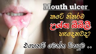 මුකයේ ඇතිවෙන උශ්න බිබිලි සදහා විසදුමHow to treat mouth ulcer [upl. by Chita]