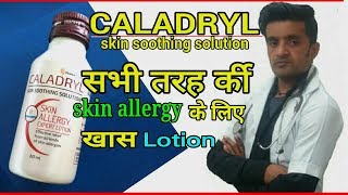 CALADRYL LOTION दाद खाज खुजली व सभी प्रकार की एलर्जी के लिए वेस्ट लोशन। [upl. by Ellenrahs]