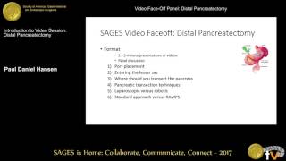 SAGES distal pancreatectomy video faceoff [upl. by Yelyk]