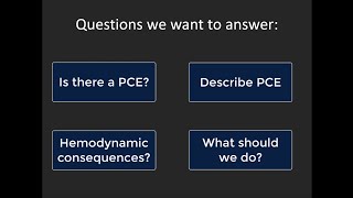 Pericardial effusions and tamponade basic POCUS evaluation [upl. by Sirromal]