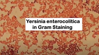 Gram Negative Rods of Yersinia enterocolitica [upl. by Micheline389]