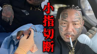 【閲覧注意】所沢のタイソンが小指を詰める！（動画あり） [upl. by Peters]