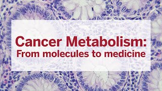 Cancer Metabolism From molecules to medicine [upl. by Bedelia793]