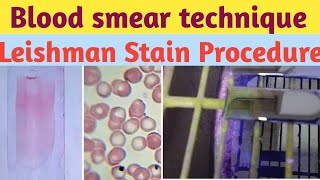 PERIPHERAL BLOOD SMEAR  HAEMATOLOGY LAB  LEISHMAN STAIN PHYSIOLOGY PRACTICALS [upl. by Sherwin]