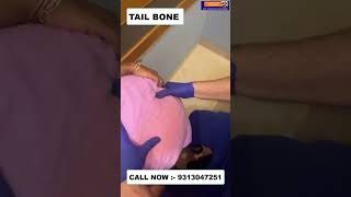 TAIL BONE  Chiropractic Treatment in Delhi  Dr Varun  Call  9313047251 doctor delhi noida [upl. by Ruhtra]