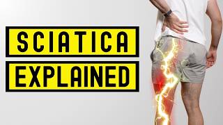 Fixing Sciatica For Good With 5 Steps You Can Take Now [upl. by Adanama868]