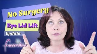 How to Get Rid of Droopy Eye Lids No Surgery Eye Lid Lift Hooded Eye Lid Lift  FACEROBICS® [upl. by Hiroko]