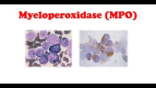 Cytochemistry 🔤  Myeloperoxidase Stain [upl. by Notterb]