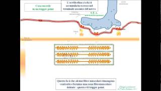 lombalgia da trigger pointsavi [upl. by Manaker]