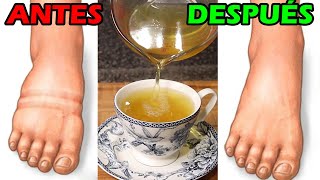 ADIOS PIES Y TOBILLOS HINCHADOS – Remedio Casero Para RETENCION DE LIQUIDO o Edema [upl. by Fedak549]