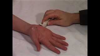 Musculoskeletal Ultrasound Hand 13 hypothenar transverse scan [upl. by Suravaj]