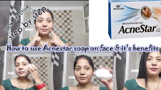 How to use Acnestar soap on faceAcnestar benefitsPimple amp acne treatmentAcneprone skin skincare [upl. by Florian]