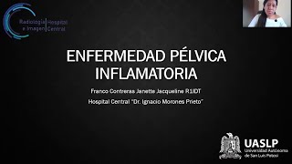 Enfermedad pelvica inflamatoria Dra Janette Jacqueline Franco Contreras [upl. by Malan]