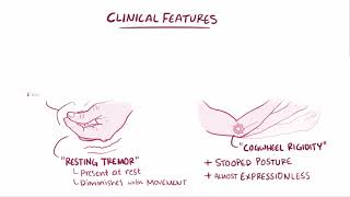 Parkinsons Disease  Osmosis [upl. by Girish]