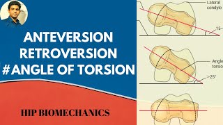 Anterversionamp Retroversion Angle of torsionhip biomechanics [upl. by Pettit]