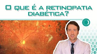 O que é a retinopatia diabética [upl. by Aicemaj]