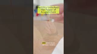 Fertility Unlocked Dr PaulMagarelli on the Power of Acupuncture amp Holistic Health [upl. by Dwyer]