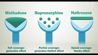 How Opioid Treatment Medications Work On Your Brain  San Diego UnionTribune [upl. by Carlyle]