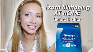 Crest 3D WHITESTRIPS Before amp After  AtHome Teeth Whitening [upl. by Snell]