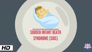 Sudden Infant Death syndrome Causes and Prevention [upl. by Airehs]