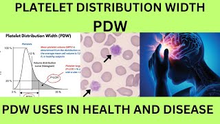 PDWPLATELET DISTRIBUTION WIDTH BLOOD TESTUSES OF PDWNORMAL RANGE CAUSES OF HIGH AND LOW PDW [upl. by Virendra]