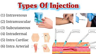 Types Of Injection and Their Site  Route of Injection  Injection Types [upl. by Sternick221]