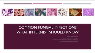 Common Fungal Infections What Internist should know [upl. by Thibaut]