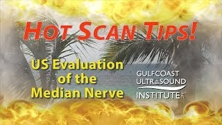 Hot Tips  Ultrasound Evaluation of the Median Nerve [upl. by Annirac272]