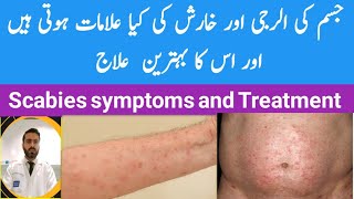 Scabies signs symptoms and its treatment  جسم میں خارش ،اس کی علامات اور علاج [upl. by Chuu]