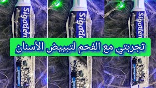 تجربتي مع الفحم لتبييضالأسنان dentifricesمعجونالاسنان [upl. by Roderica890]