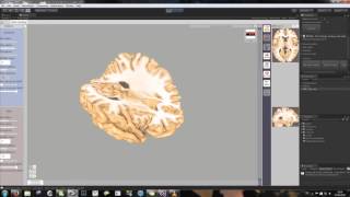 UNITY  3D realtime brain cuts [upl. by Anders]