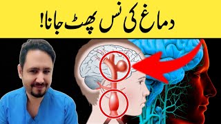 Brain Aneurysm A Silent Killer  Dr Irfan [upl. by Coretta]